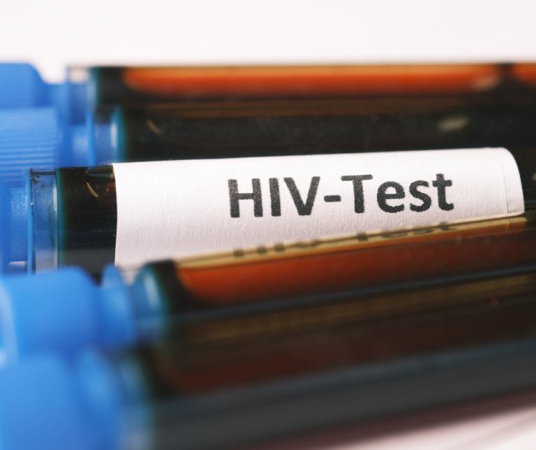 hiv test